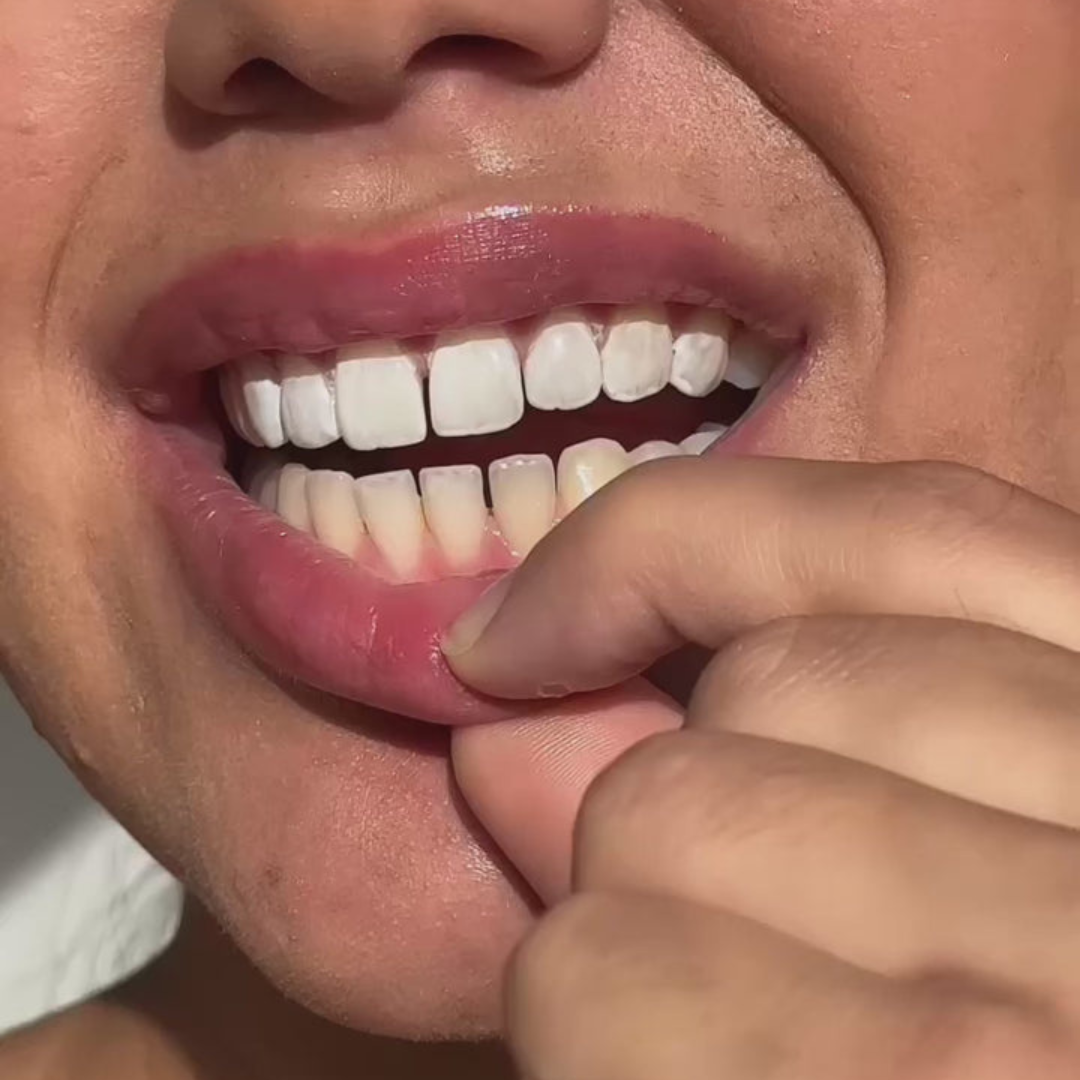 Pearl Brush - Instant White Teeth