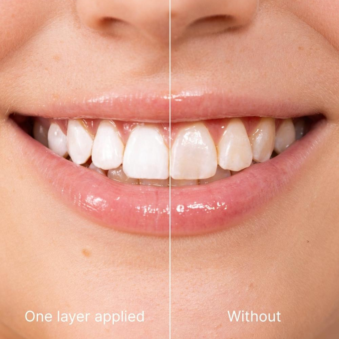 Pearl Brush - Instant White Teeth